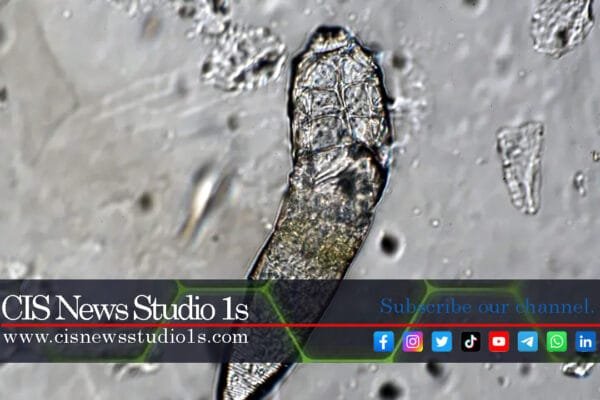 The Mite Party on Your Face at Night | #CISNewsStudio1s