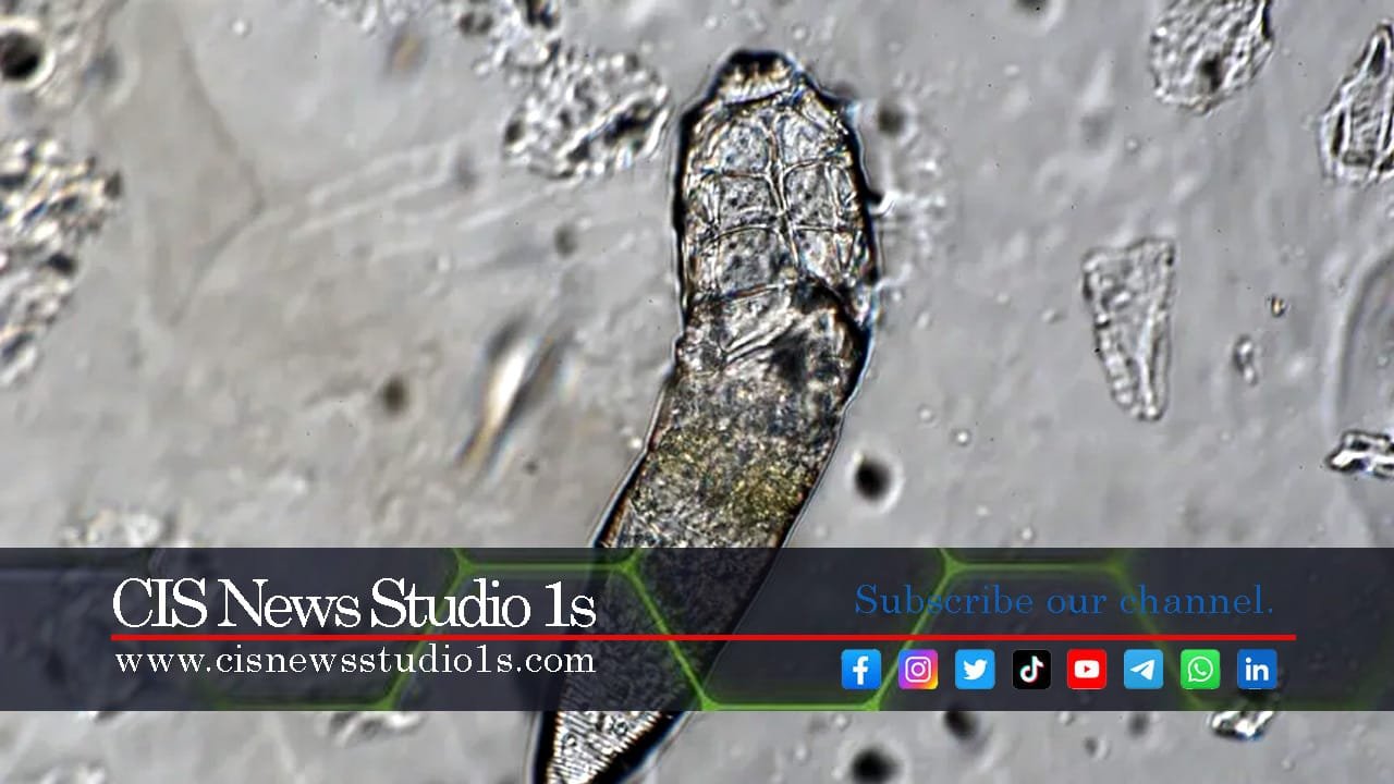 The Mite Party on Your Face at Night | #CISNewsStudio1s